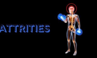 Attrities