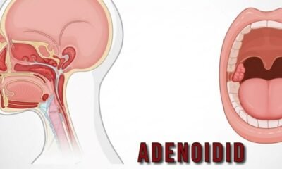 Adenoidid
